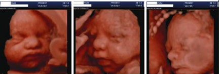 Ecografía 4D — Imagen 14