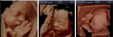 Ecografía 4D — Imagen 16