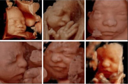 Ecografía 4D — Imagen 20