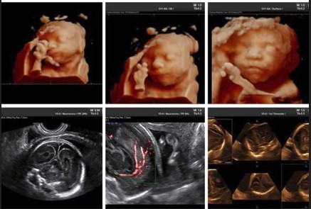 Ecografía 4D — Imagen 22