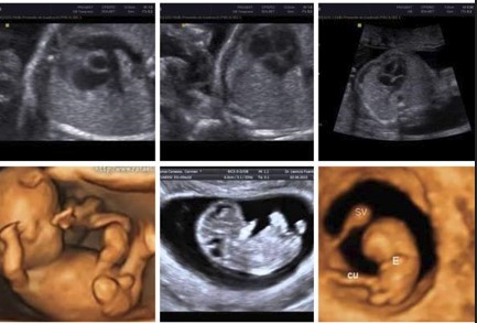Ecografía 4D — Imagen 24