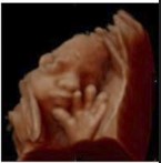 Ecografía 4D — Imagen 3