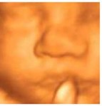 Ecografía 4D — Imagen 5