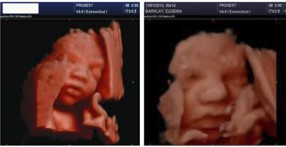 Ecografía 4D — Imagen 6