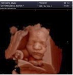 Ecografía 4D — Imagen 7