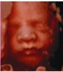 Ecografía 4D — Imagen 8